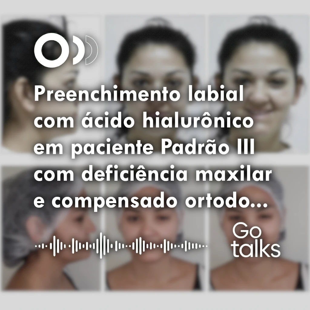 Preenchimento labial com ácido hialurônico em paciente Padrão III com deficiência maxilar e compensado ortodonticamente: relato de caso