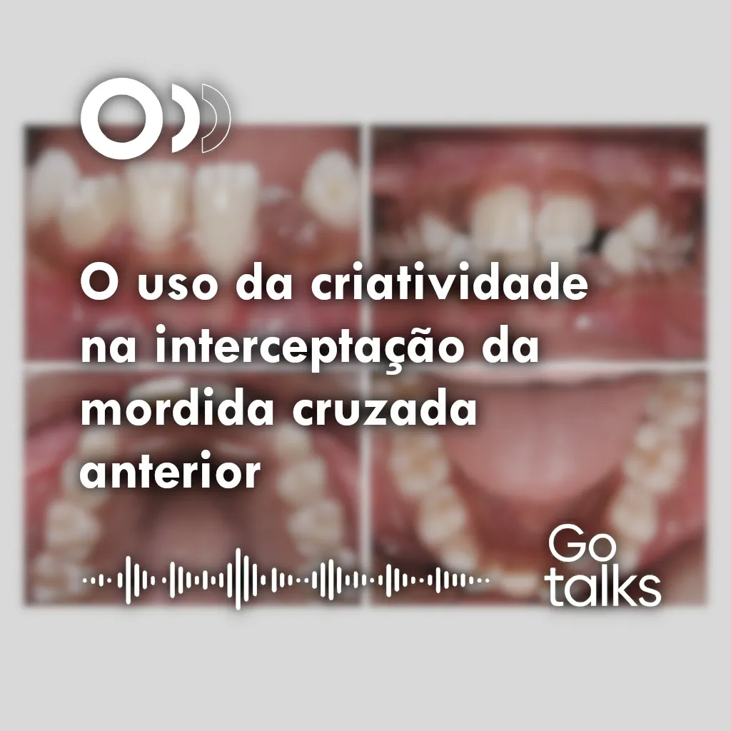 O uso da criatividade na interceptação da mordida cruzada anterior