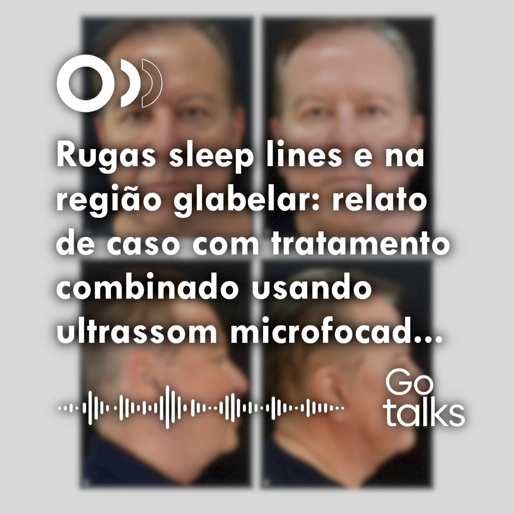 Rugas sleep lines e na região glabelar: relato de caso com tratamento combinado usando ultrassom microfocado, toxina botulínica e fios de polidioxanona