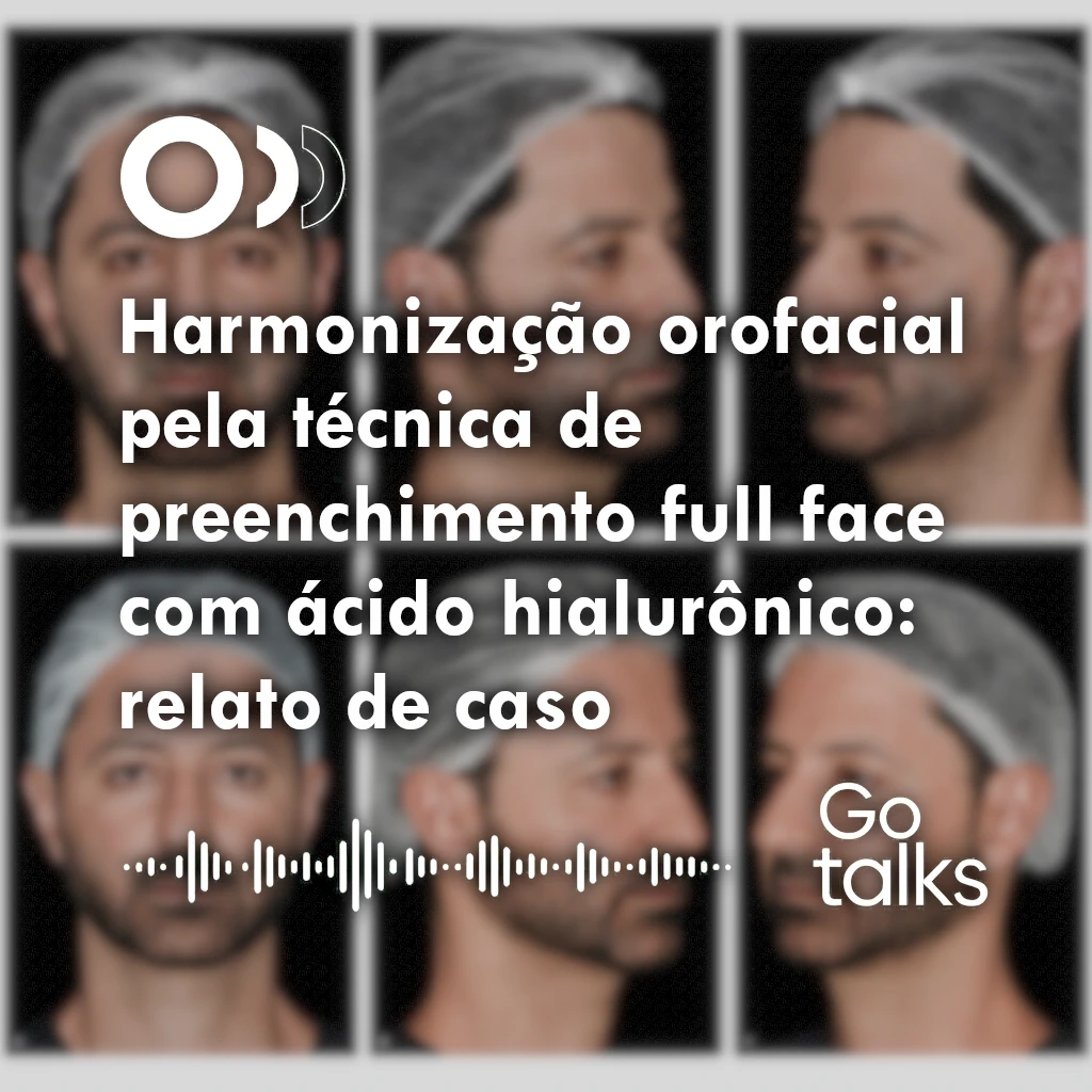 Harmonização orofacial pela técnica de preenchimento full face com ácido hialurônico: relato de caso