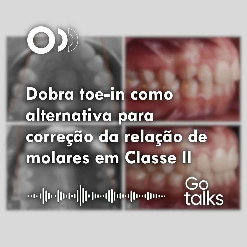 Dobra toe-in como alternativa para correção da relação de molares em Classe II