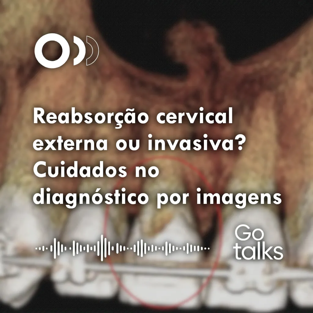 Reabsorção cervical externa ou invasiva? Cuidados no diagnóstico por imagens