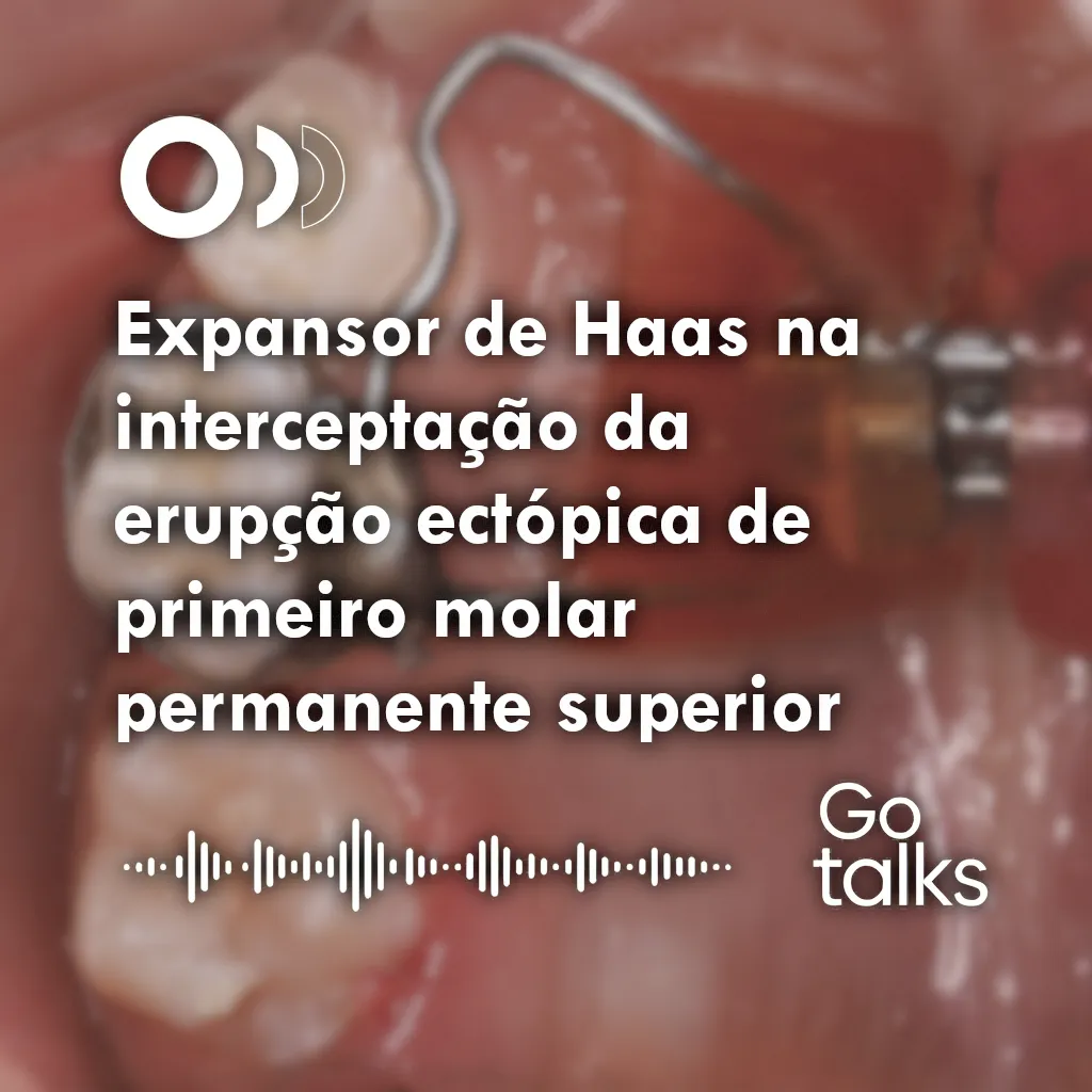 Expansor de Haas na interceptação da erupção ectópica de primeiro molar permanente superior