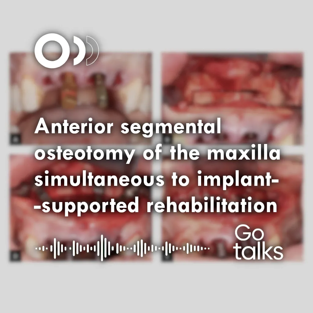 Anterior segmental osteotomy of the maxilla simultaneous to implant-supported rehabilitation