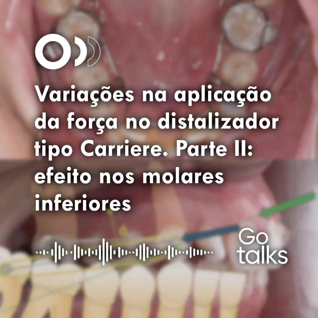 Variações na aplicação da força no distalizador tipo Carriere. Parte II: efeito nos molares inferiores