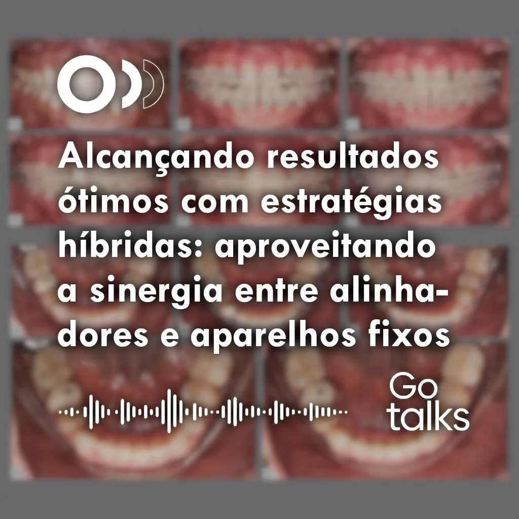 Alcançando resultados ótimos com estratégias híbridas: aproveitando a sinergia entre alinhadores e aparelhos fixos