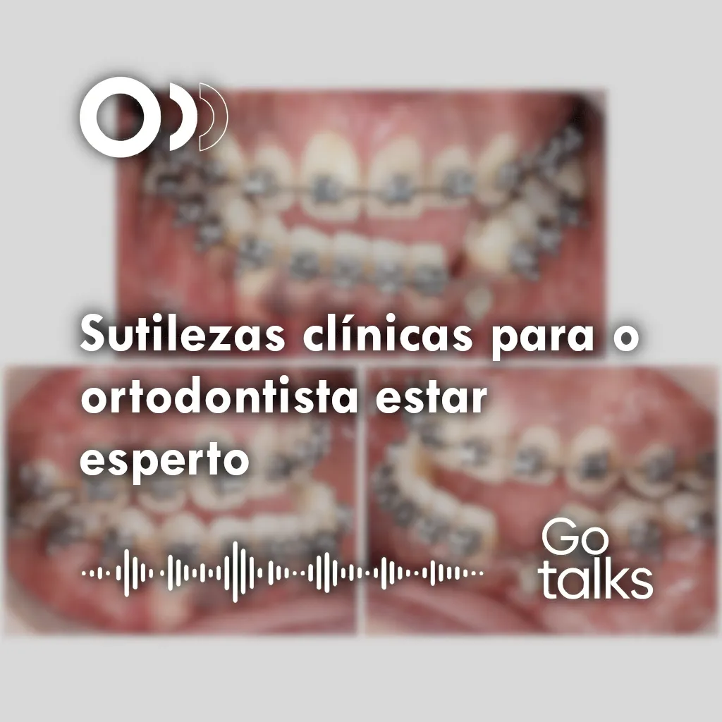 Sutilezas clínicas para o ortodontista estar esperto