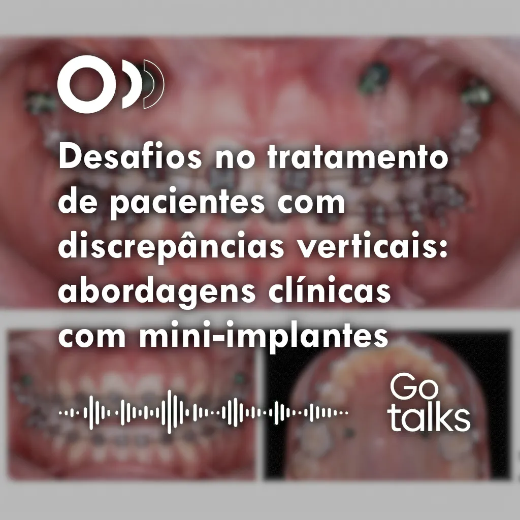Desafios no tratamento de pacientes com discrepâncias verticais: abordagens clínicas com mini-implantes