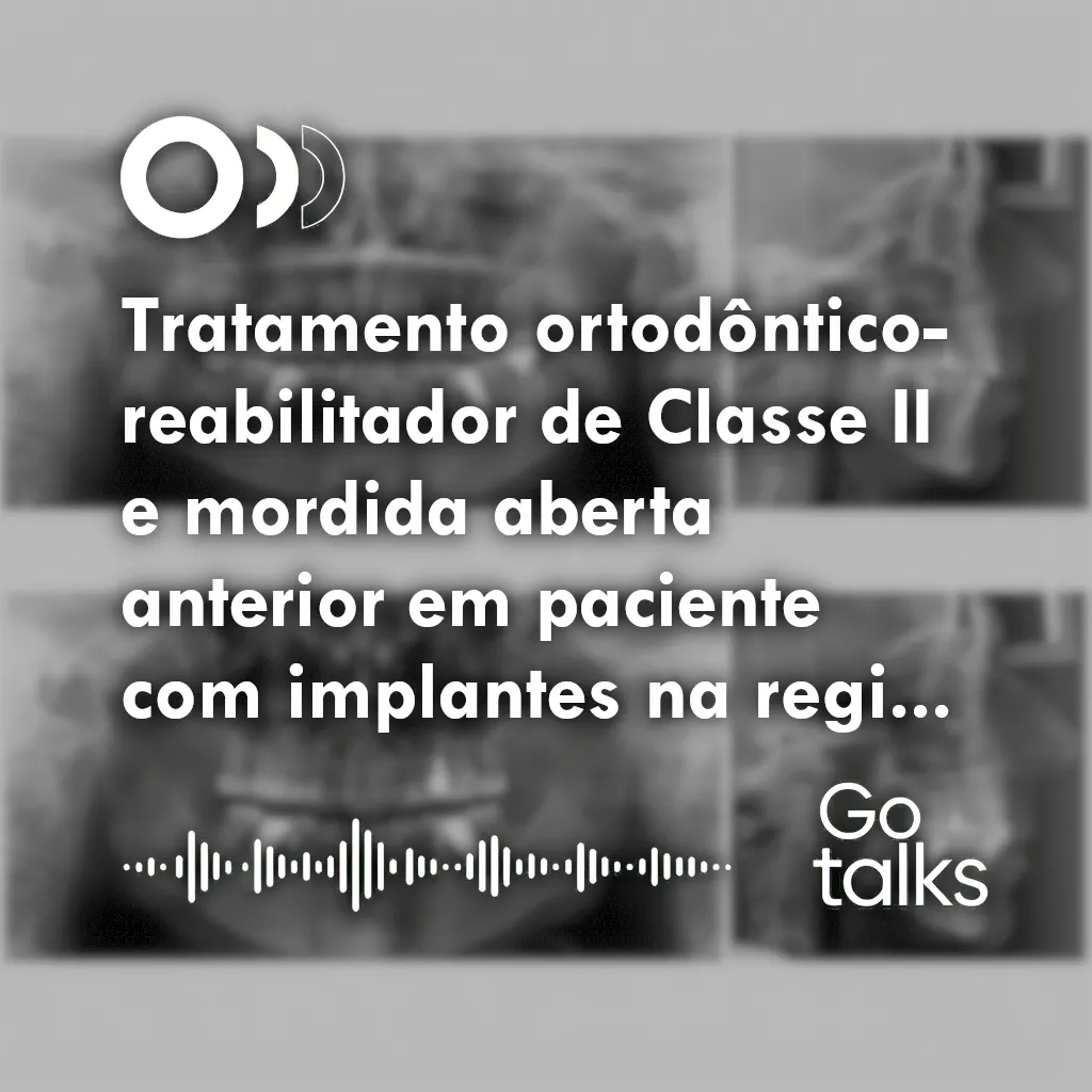 Tratamento ortodôntico-reabilitador de Classe II e mordida aberta anterior em paciente com implantes na região dos primeiros molares inferiores: relato de caso tratado com alinhadores