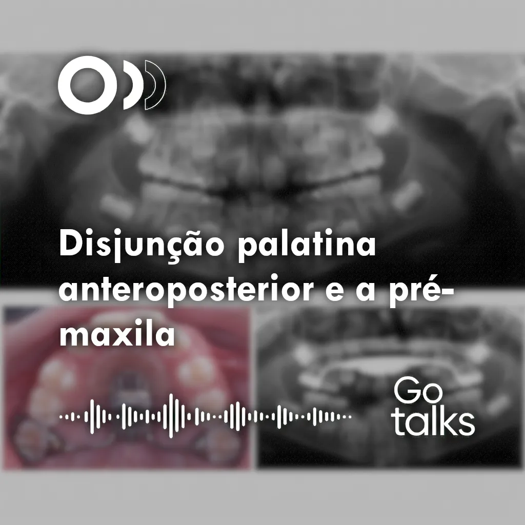 Disjunção palatina anteroposterior e a pré-maxila