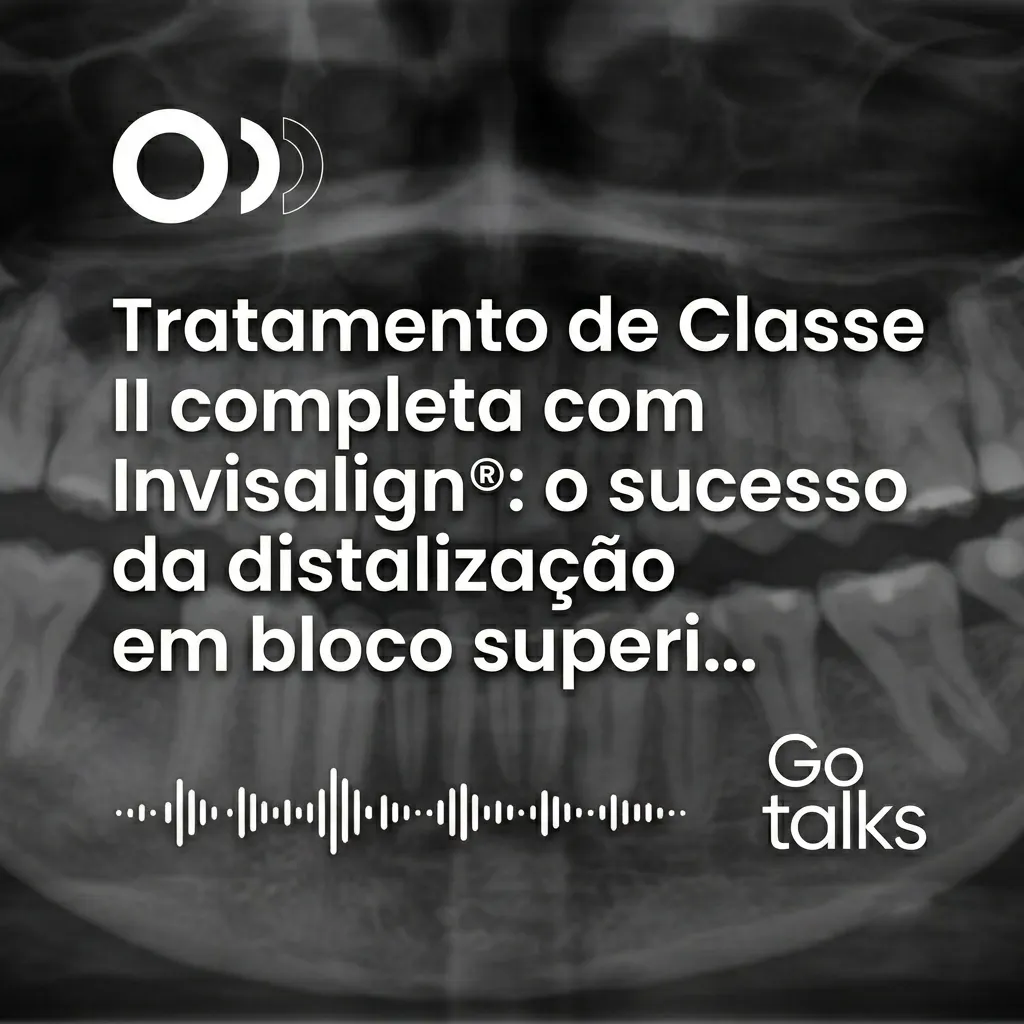 Tratamento de Classe II completa com Invisalign®: o sucesso da distalização em bloco superior sem a remoção imediata de terceiros molares